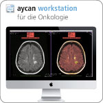 aycan workstation für die Onkologie