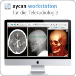 aycan workstation für die Teleradiologie