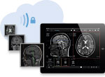 Mehr über Teleradiologie in der Private Cloud mit aycan telerad