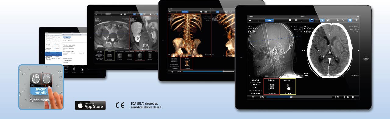 aycan mobile - die Teleradiologie iPad App